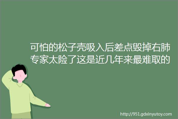 可怕的松子壳吸入后差点毁掉右肺专家太险了这是近几年来最难取的异物